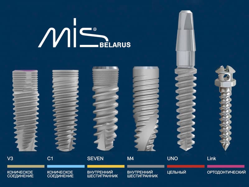 Обзор израильских имплантов MIS - цены, мнение стоматологов