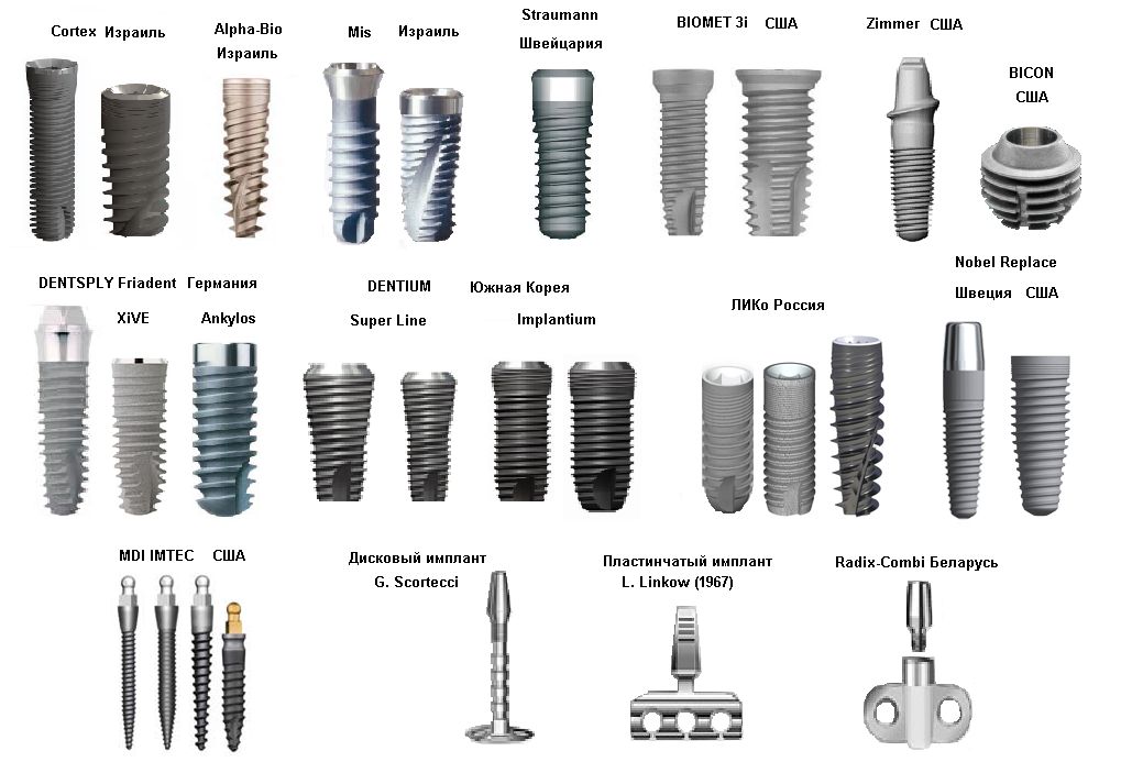 какие бывают импланты зубов