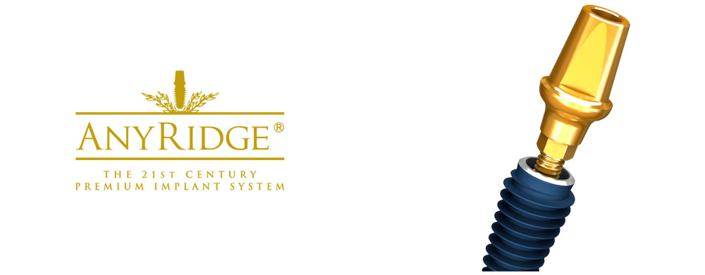 Имплантаты MegaGen AnyRidge