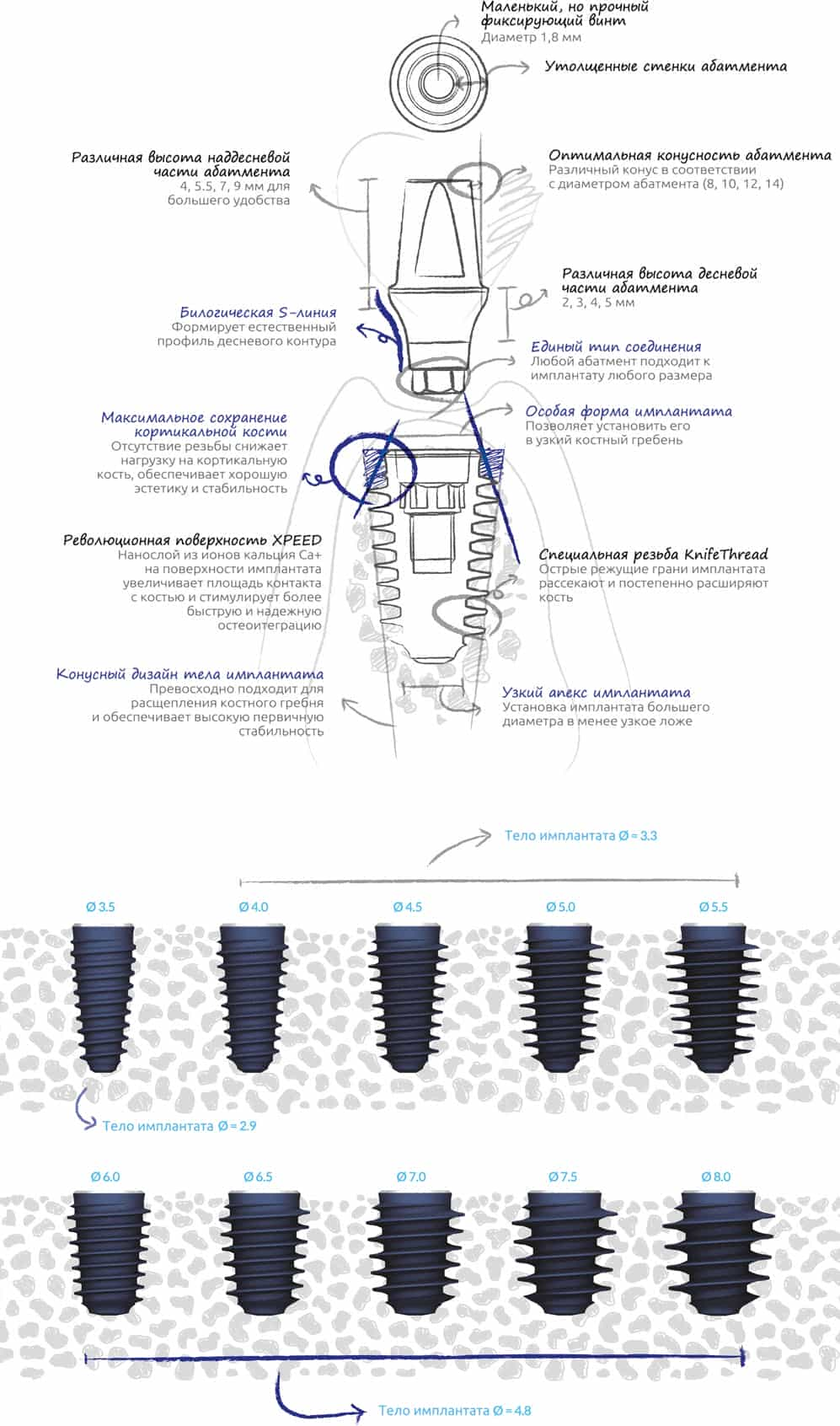 Megagen импланты. ANYRIDGE Implant System коробка. ANYRIDGE импланты набор хирургический протокол. Набор Megagen ANYRIDGE.