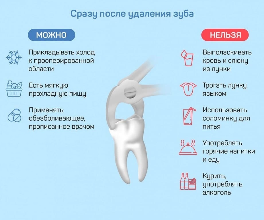 Уход за лункой после удаления зуба